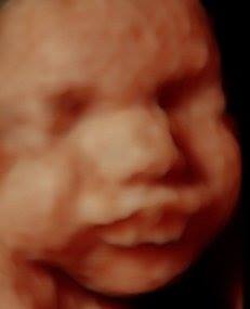 Sample Image 3D/4D Sonography